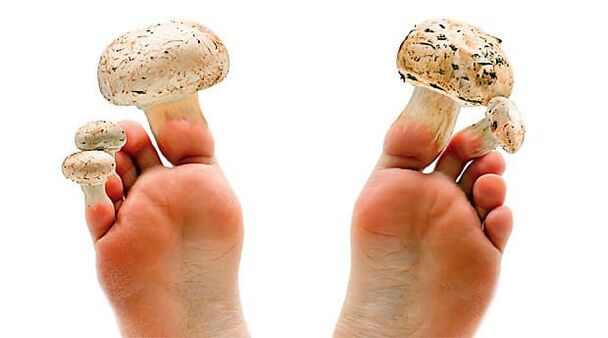 Champignon des ongles des pieds qui peut être évité