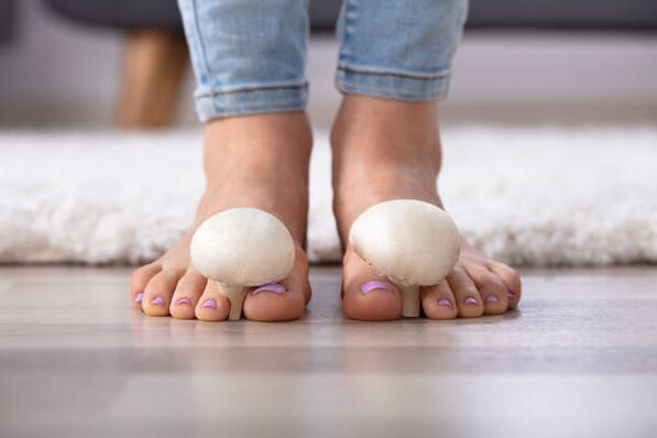 champignon sur les ongles