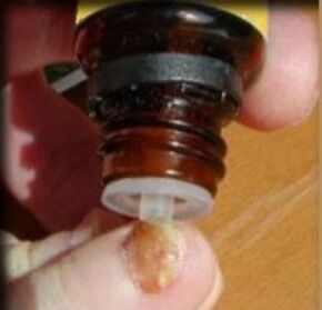 Appliquer des gouttes sur un ongle atteint de champignon